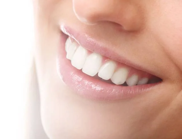 Close do sorriso de uma mulher mostrando dentes brancos restaurados por um dentista, com lábios rosados e um fio de saliva conectando os dentes superiores e inferiores.